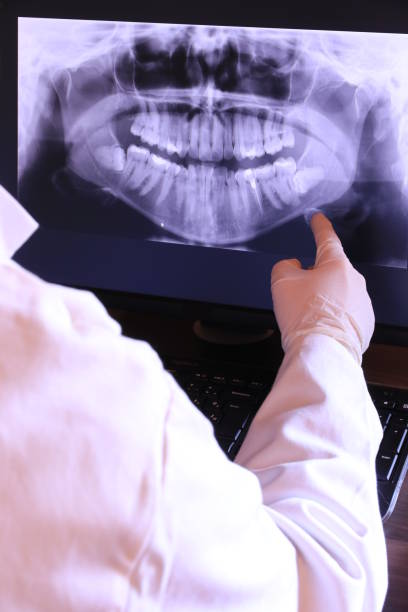 Best Emergency Broken Tooth Repair in Montrose, VA